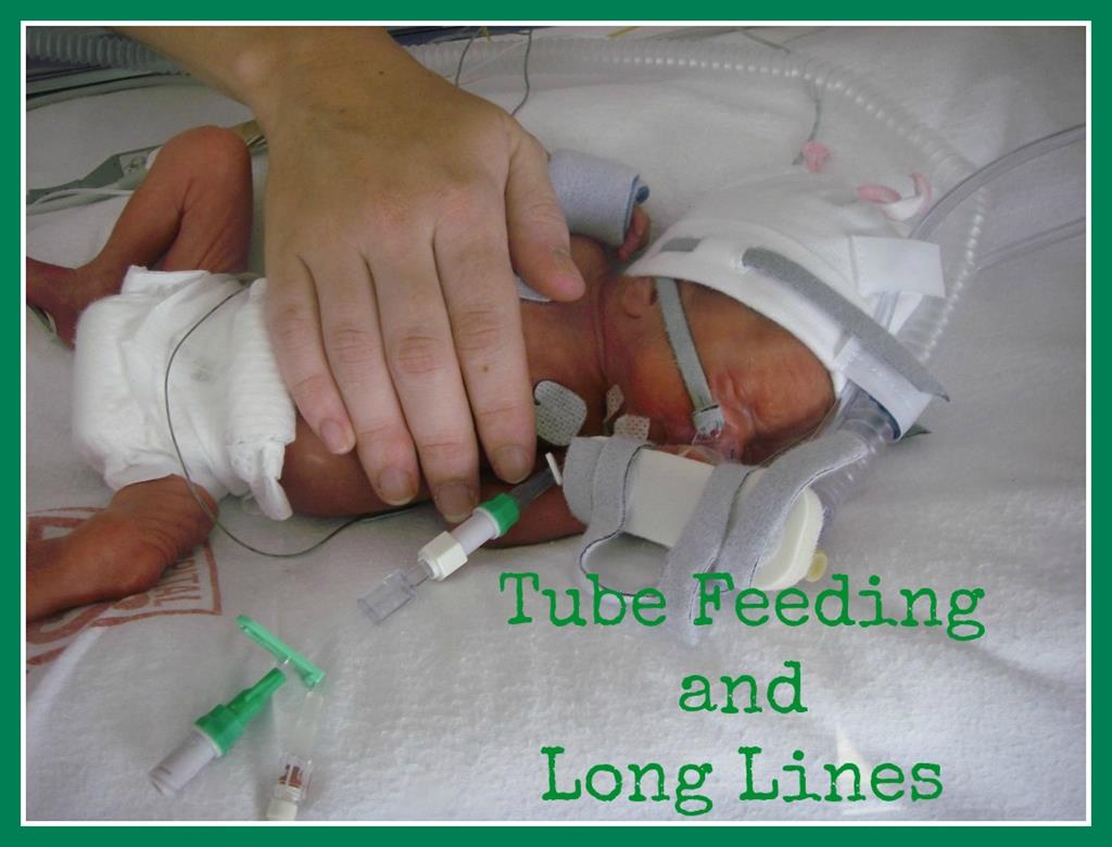 tube feed long line
